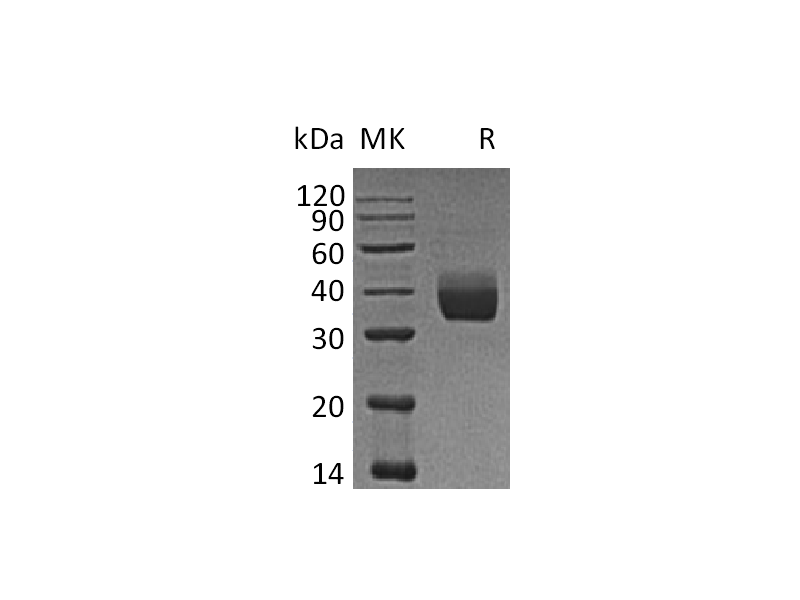 Recombinant Human LILRA5 (C-6His)