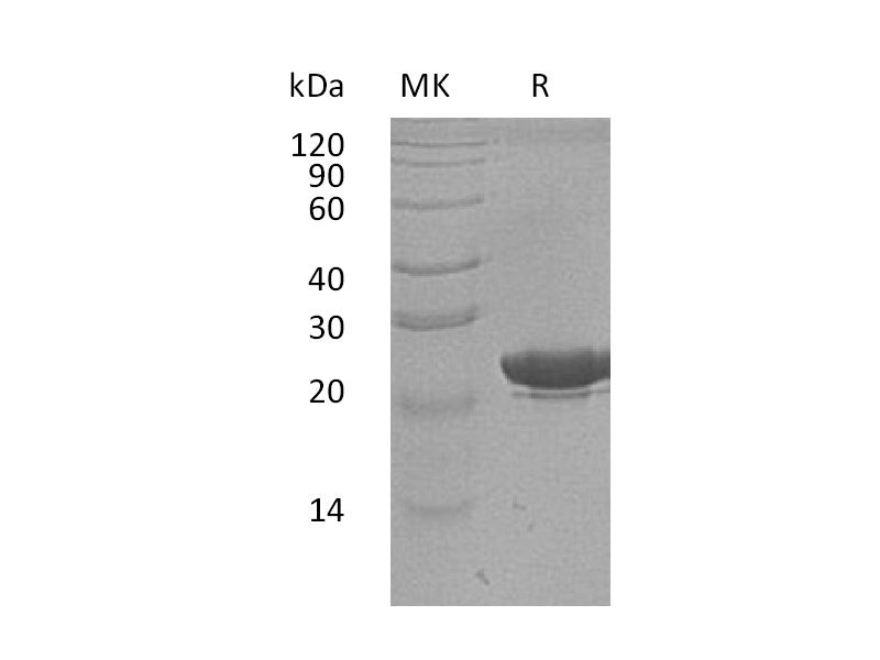 Recombinant Human NGAL (C-6His, Human Cells)