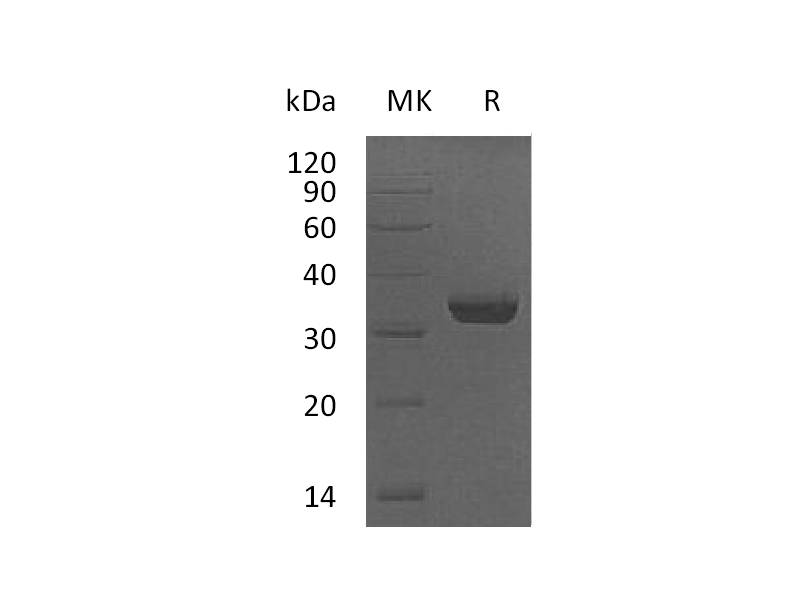 Recombinant Human VIP36 (C-6His)