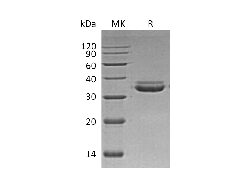 Recombinant Human LMAN2L (C-6His)