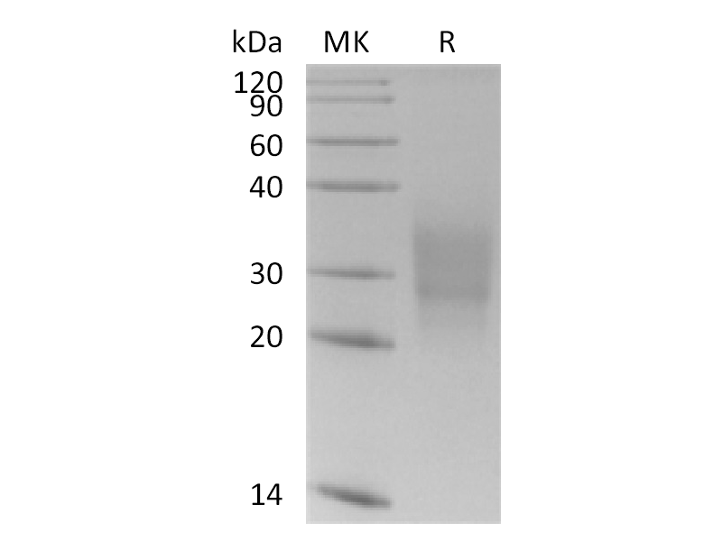 Recombinant Human CD300a (C-6His)