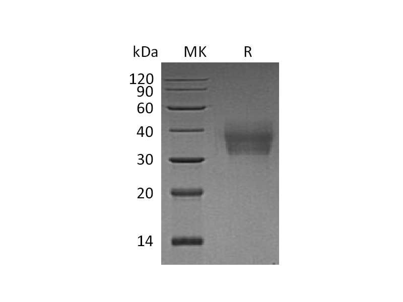 Recombinant Human LMIR2 (C-6His)