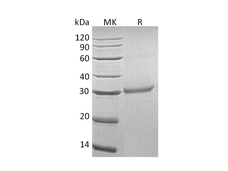 Recombinant Human OLR1 (C-6His)
