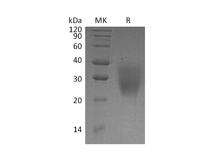 Recombinant Human LRRC25 (C-6His)