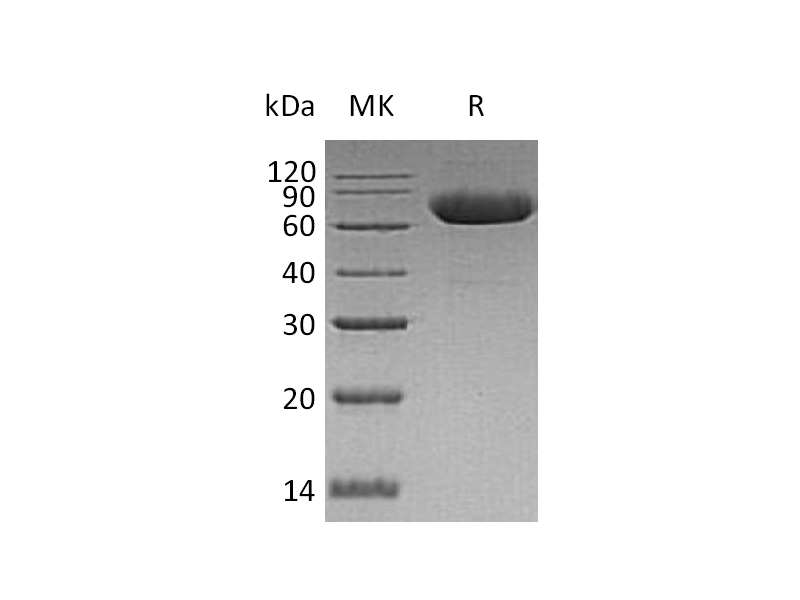 Recombinant Human LRRTM2 (C-6His)