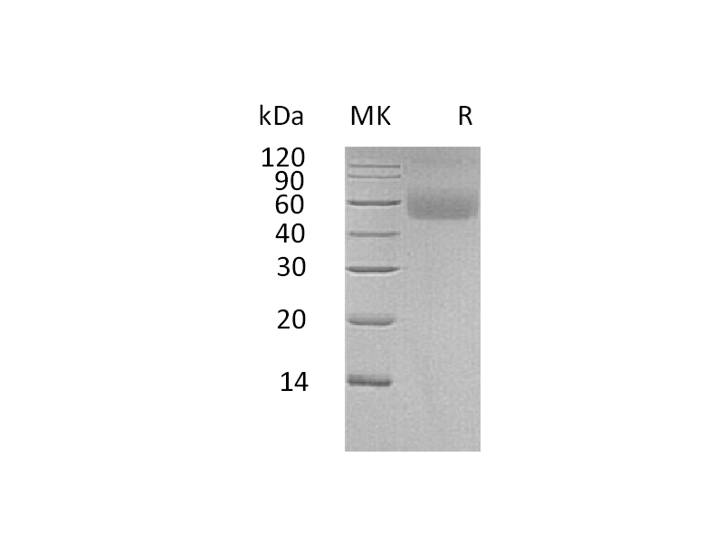 Recombinant Human LAMP (C-6His)