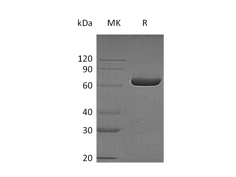 Recombinant Human LTA4H (C-6His)