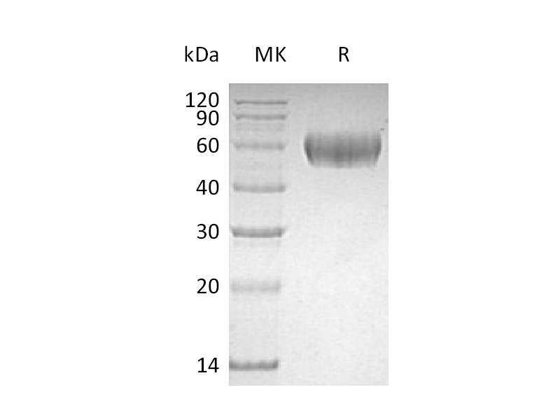 Recombinant Human Lumican (C-6His)