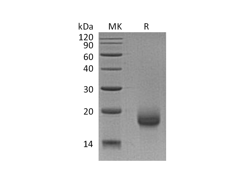 Recombinant Human LY6H (C-6His)