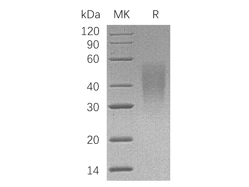 Recombinant Human CD58 (C-6His)