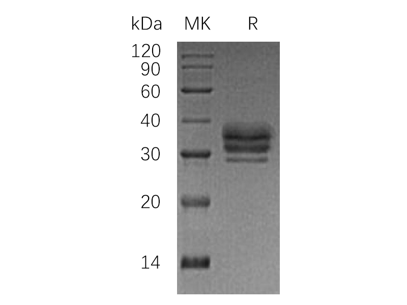 Recombinant Human LTBR (C-6His)
