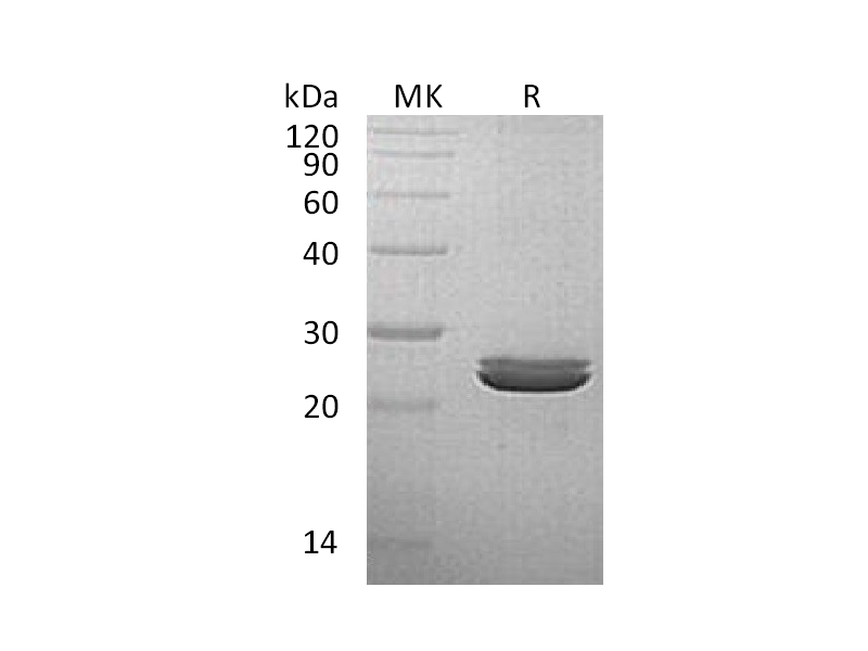 Recombinant Human LYG2 (C-6His)
