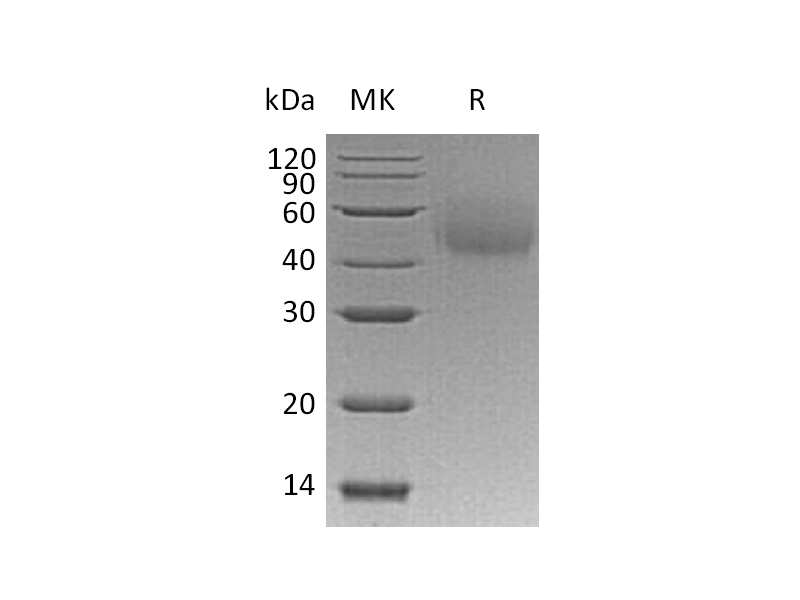 Recombinant Human LYVE-1 (C-6His)