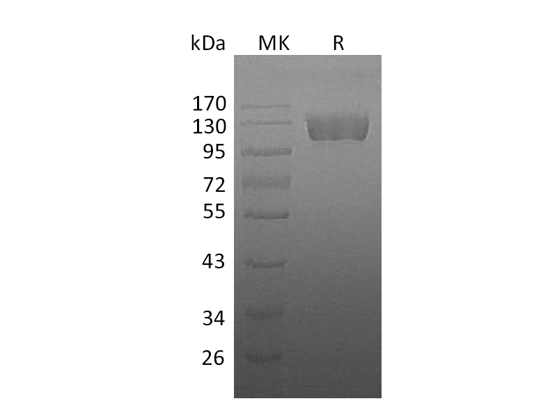 Recombinant Human M-CSF R (C-Fc)