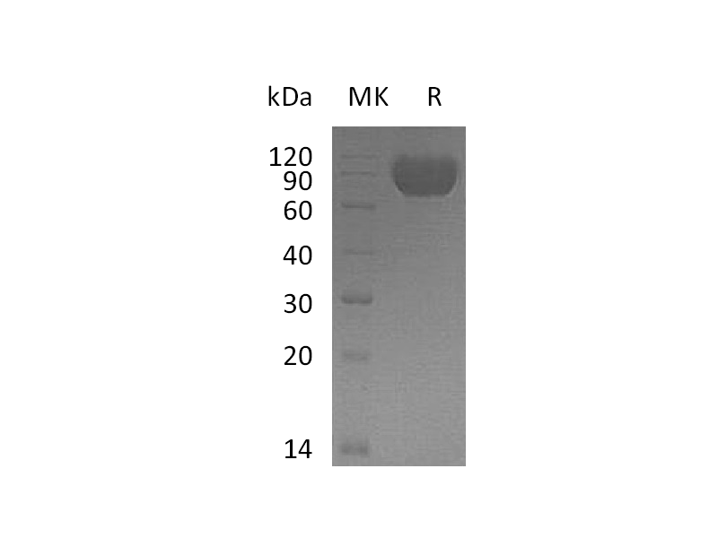 Recombinant Human MAG (C-6His)