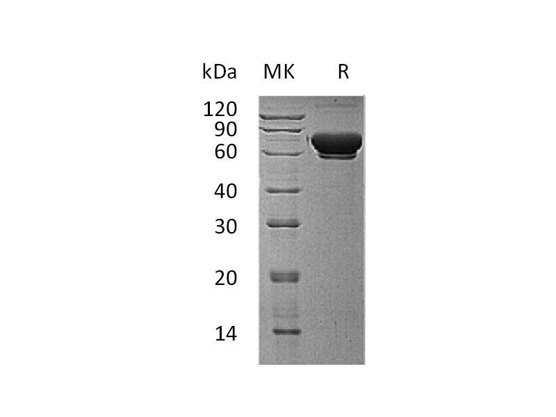 Recombinant Human MAN1B1 (C-6His)