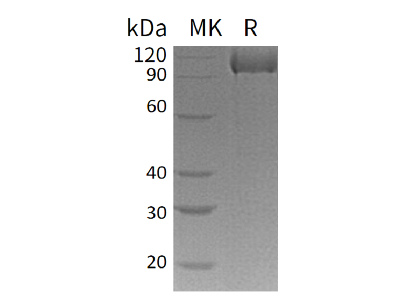 Recombinant Human Complement Factor MASP3 (C-6His)