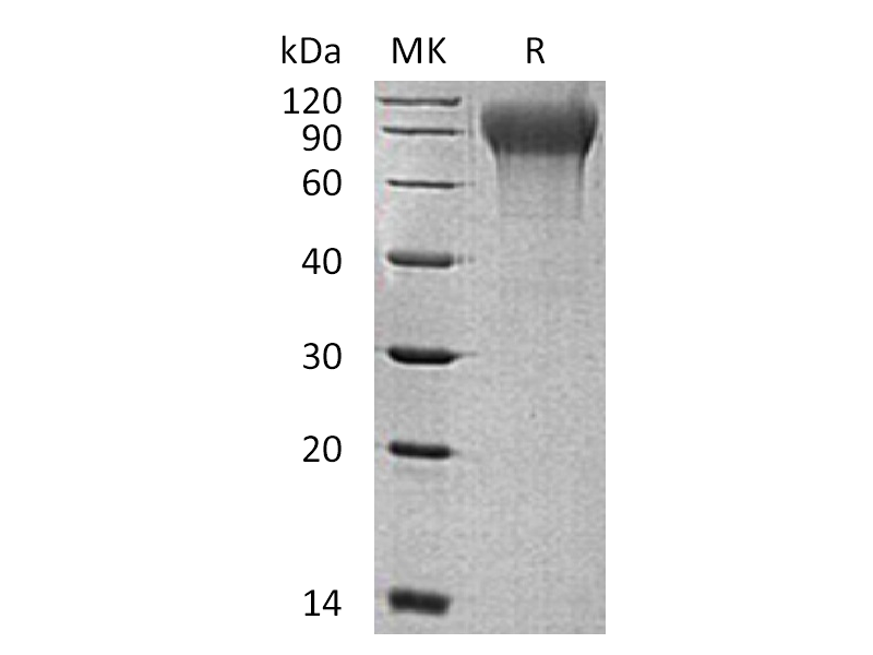 Recombinant Human MANSC1 (C-6His)