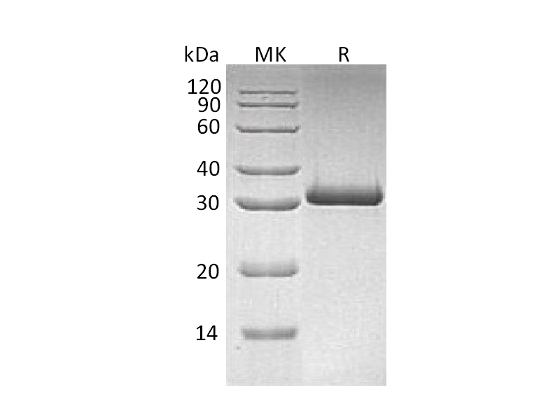 Recombinant Human MBL-2 (C-6His)