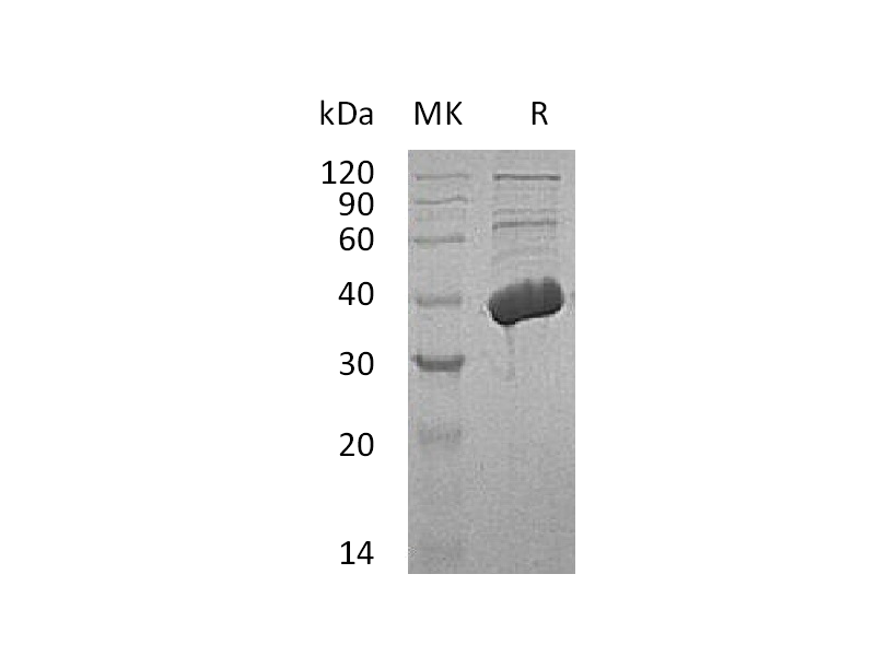 Recombinant Human MECR (C-6His)