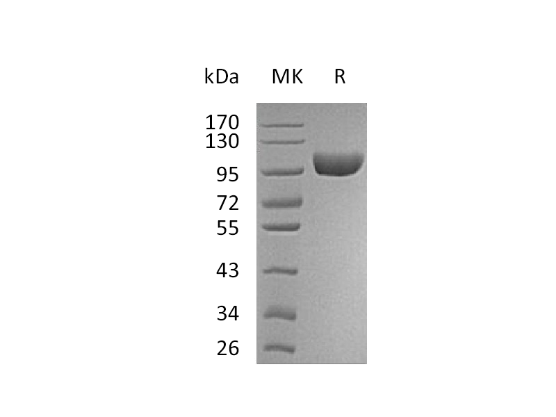 Recombinant Human AOC3 (C-6His)