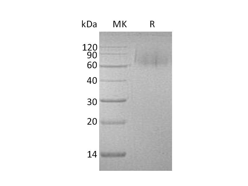 Recombinant Human MerTK (C-6His)