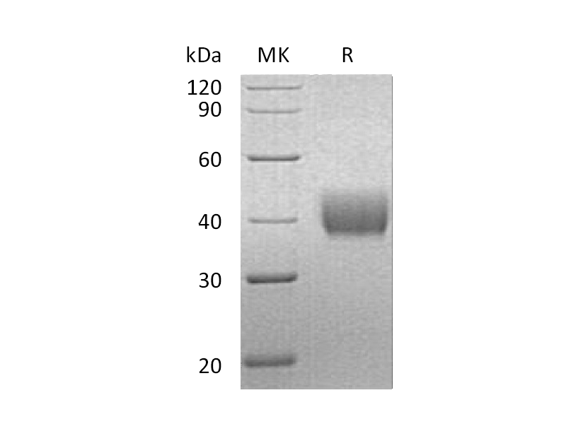 Recombinant Human Mesothelin (C-6His)
