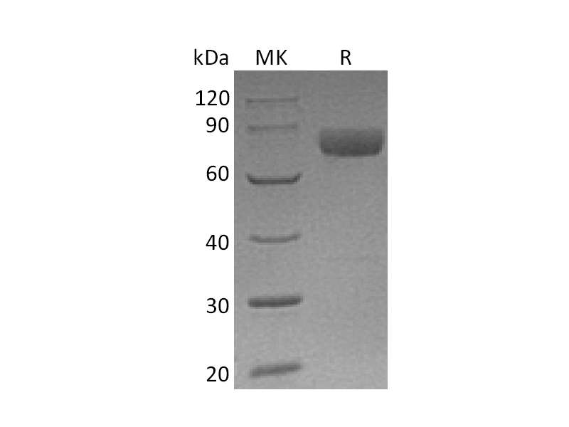 Recombinant Human Mesothelin (C-Fc)