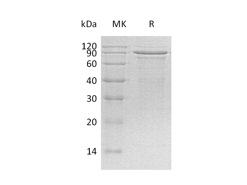 Recombinant Human MECP2 (C-6His)