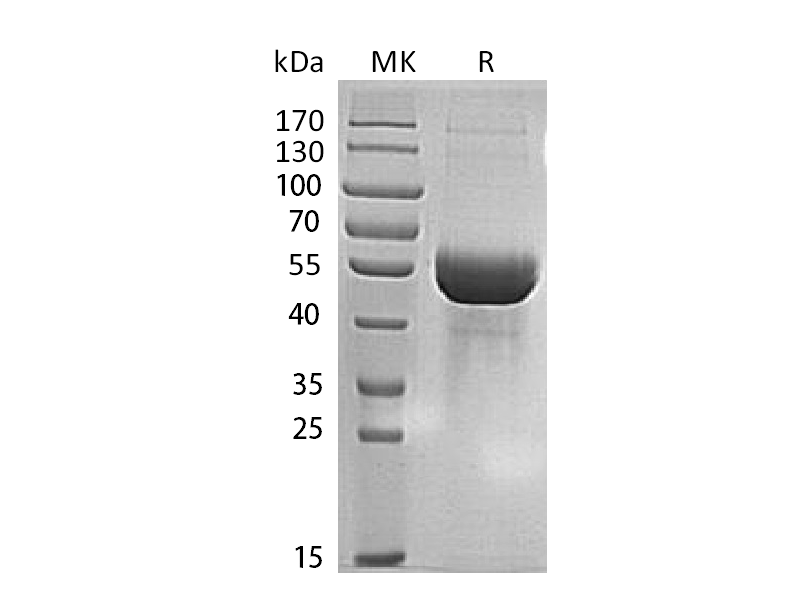 Recombinant Human MINPP1 (C-6His)