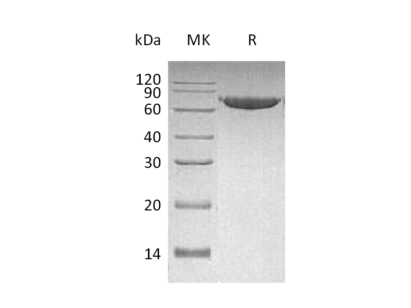 Recombinant Human MMP-2 (C-6His)