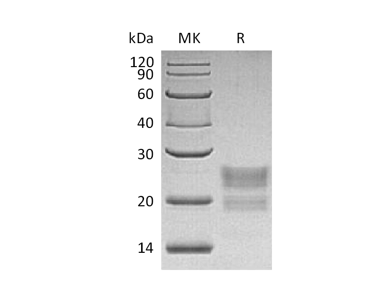 Recombinant Human MPZL1 (C-6His)