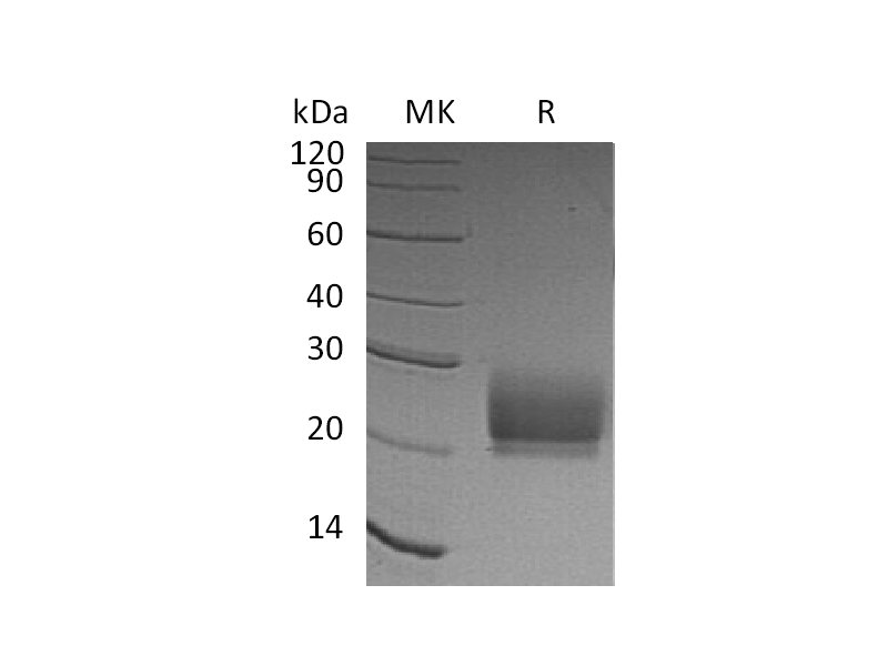 Recombinant Human CD94 (N-6His)