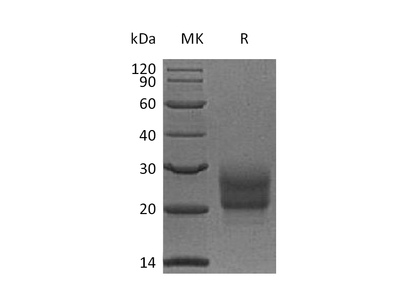 Recombinant Human NCR3 (C-6His)