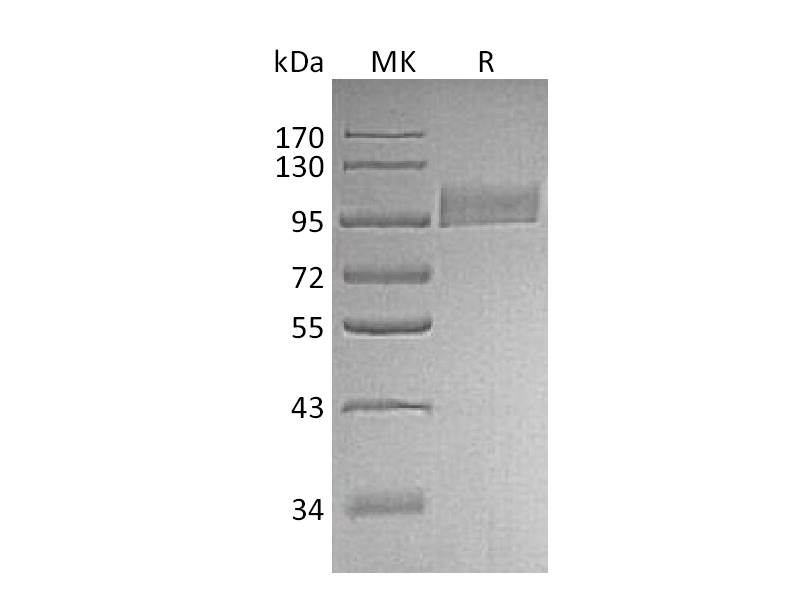 Recombinant Human Neprilysin (N-8His)