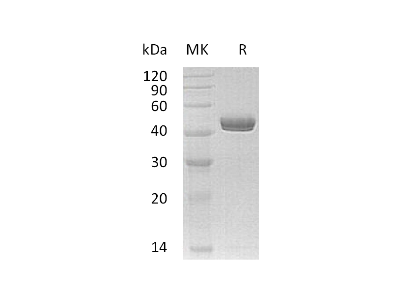 Recombinant Human NTNG1 (C-6His)