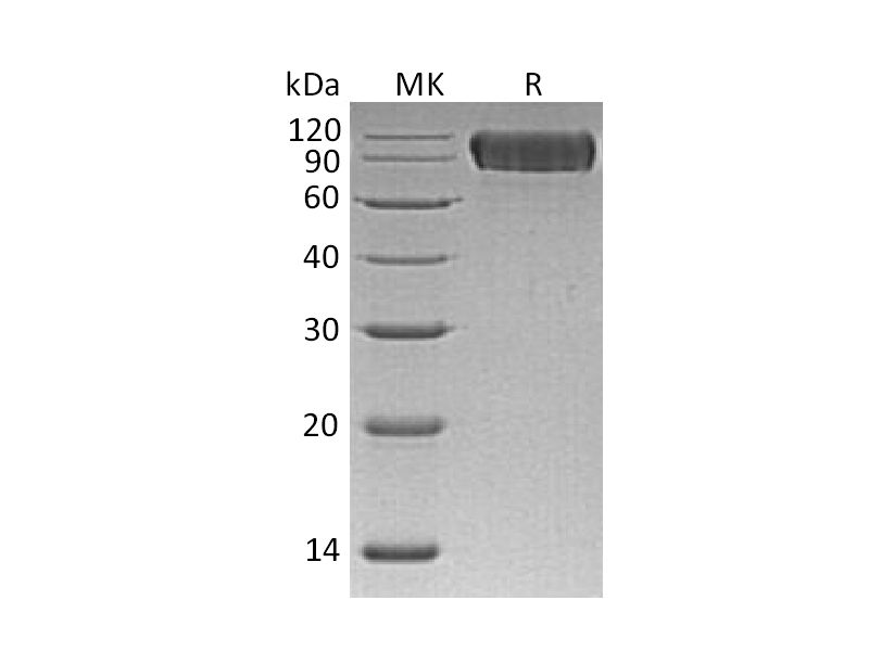 Recombinant Human NLGN1 (C-6His)