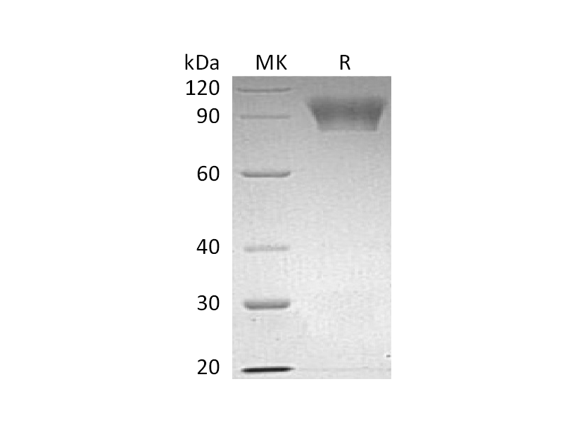 Recombinant Human NLGN4X (C-6His)