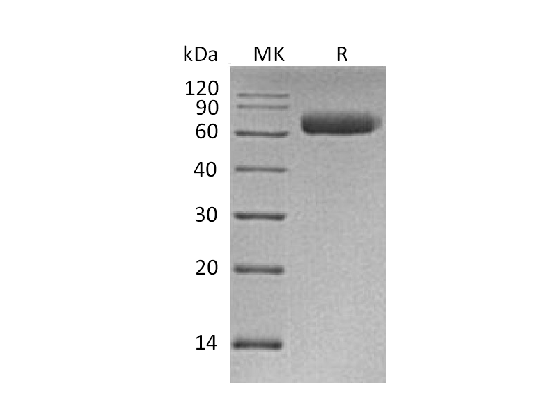 Recombinant Human NgR3 (C-6His)