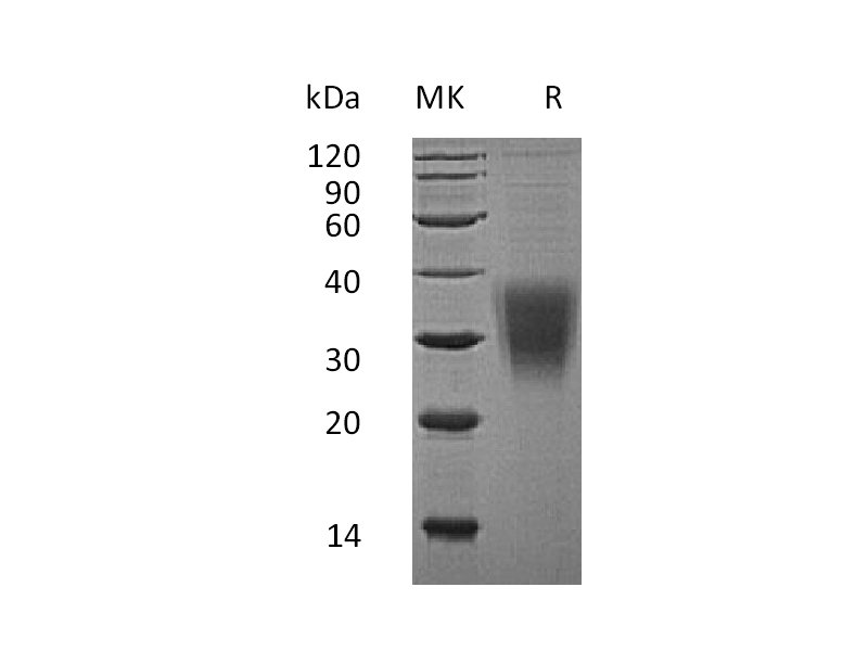 Recombinant Human NKG2A (N-8His)