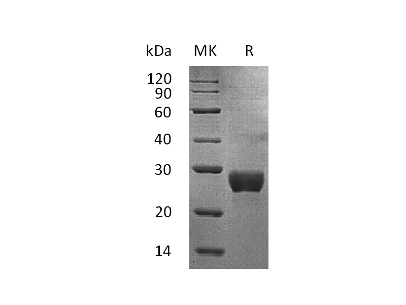 Recombinant Human NKG2DL (C-6His)