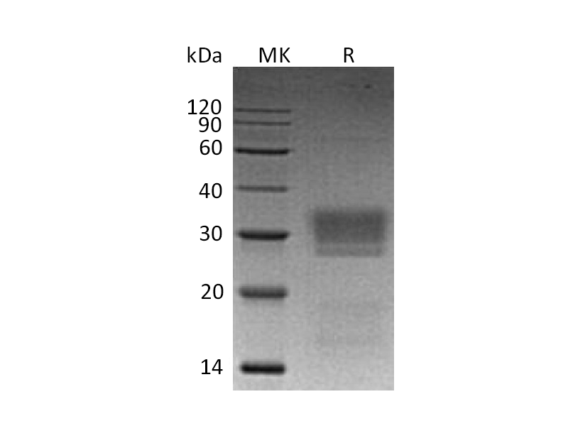 Recombinant Human NKG2DL2 (C-6His)