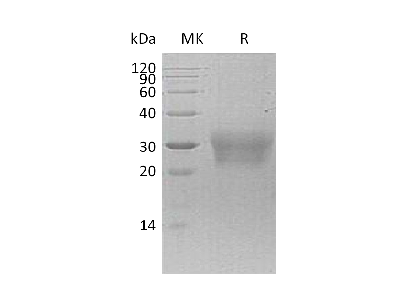 Recombinant Human NPDC1 (C-6His)