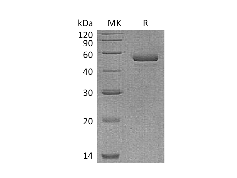 Recombinant Human NPTX1 (C-6His)