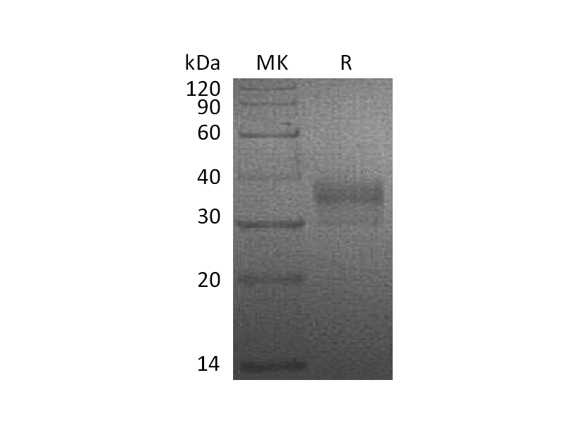 Recombinant Human NTAL (C-6His)