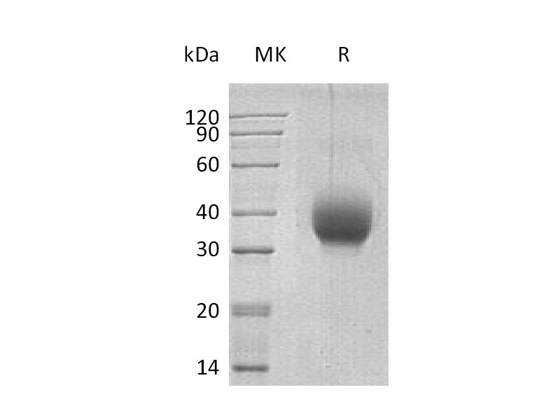 Recombinant Human SLAMF6 (C-6His)