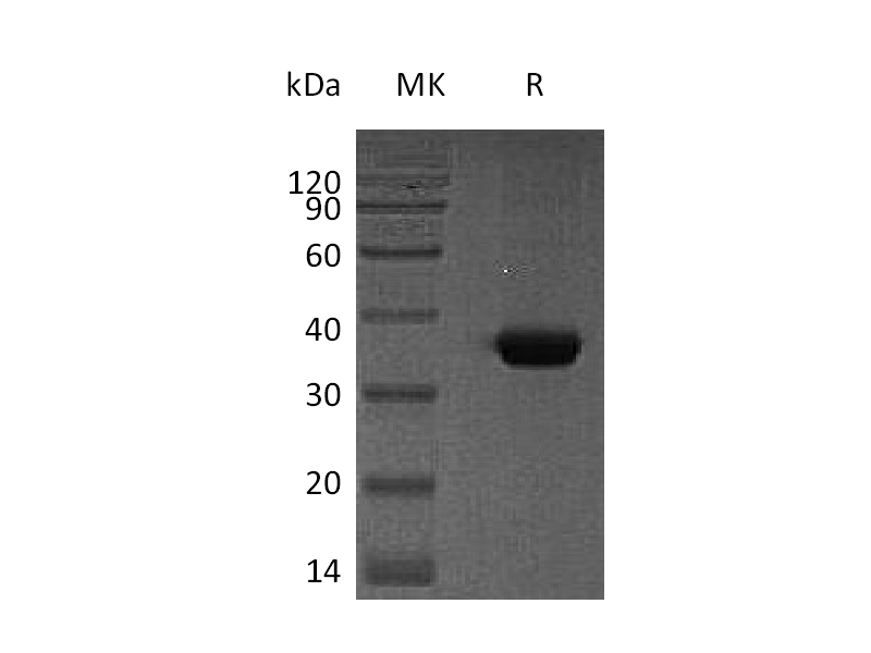 Recombinant Human SPARC (C-6His)