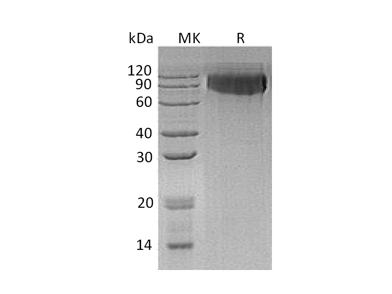 Recombinant Human GPNMB (C-6His)