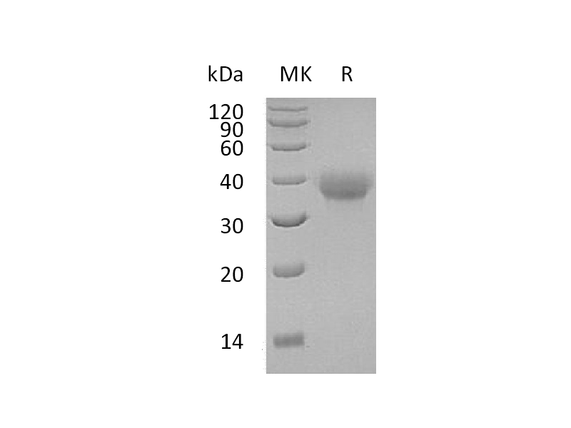 Recombinant Human OX40 (C-6His)