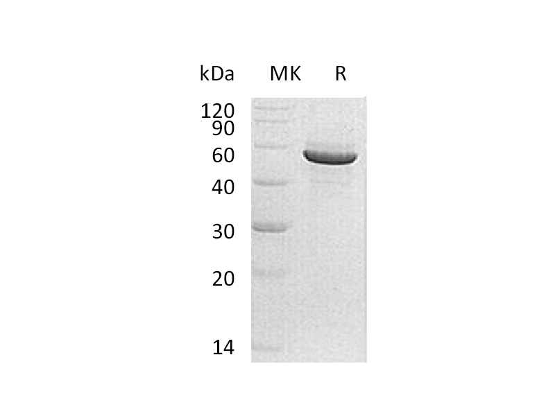 Recombinant Human PACSIN1 (C-6His)